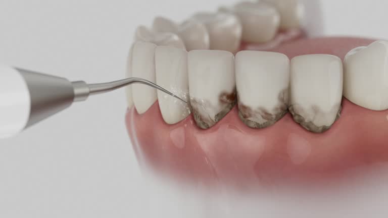 Reliable Dental contractor in St. Marys, OH by Dentist Open Now